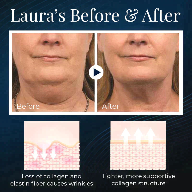 NuBeauty+ Sleeping V-Face Beauty Device