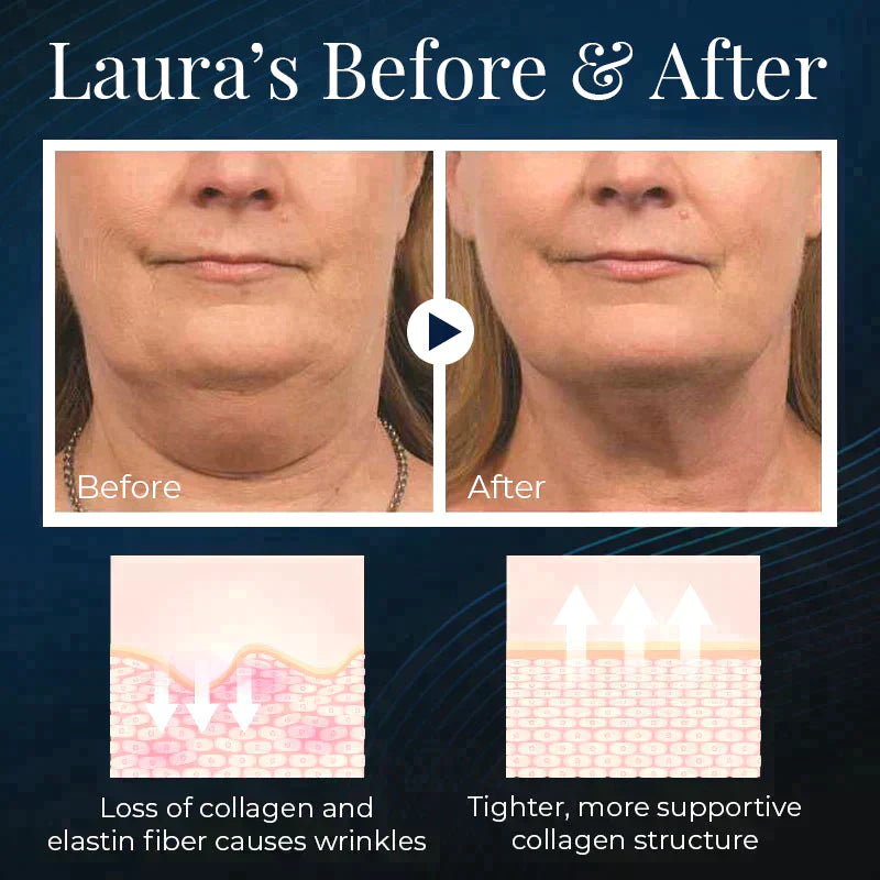 NuBeauty+ Sleeping V-Face Beauty Device
