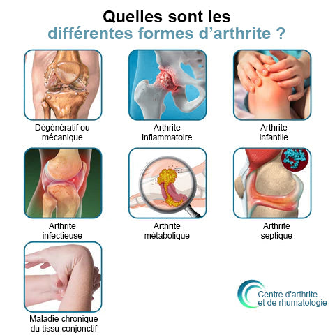 Dobshow™Crème hydratante avancée pour la réparation des articulations et des os🎉🐝