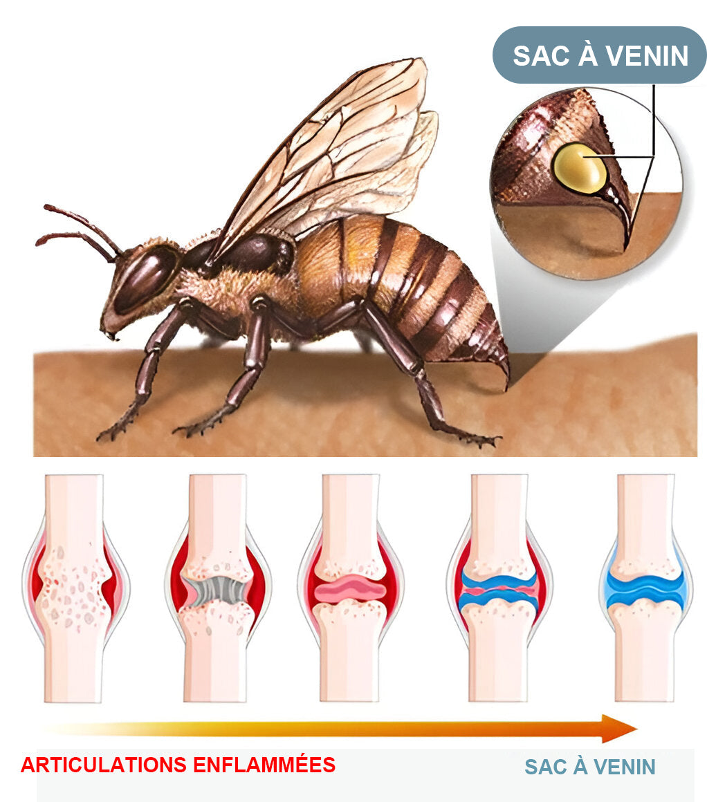Dobshow™Crème hydratante avancée pour la réparation des articulations et des os🎉🐝