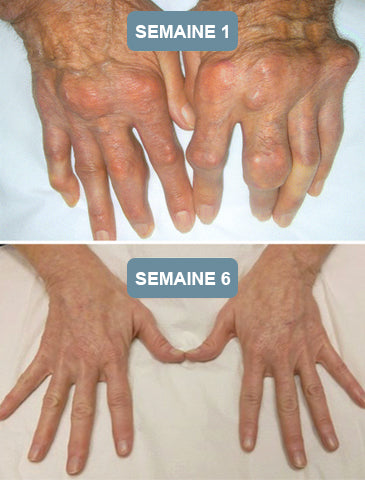 Dobshow™Crème hydratante avancée pour la réparation des articulations et des os🎉🐝