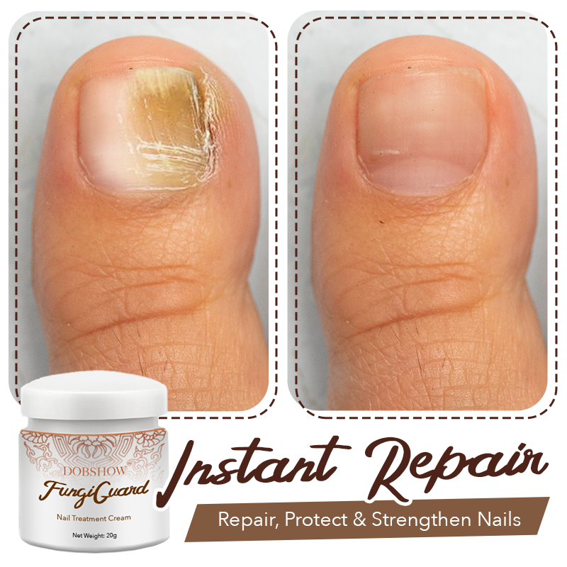 Dobshow™ FungiGuard Nail Treatment Cream