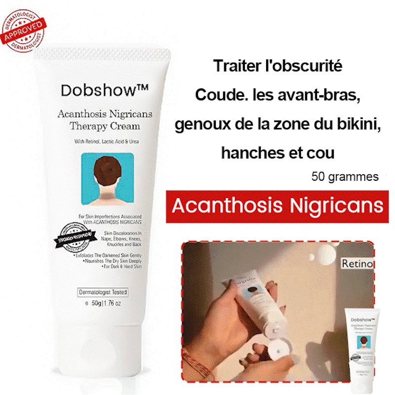 Dobshow™ Acanthosis Nigricans Hyperpigmentation Therapy Cream