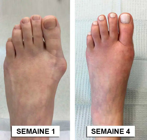 Dobshow™Crème hydratante avancée pour la réparation des articulations et des os🎉🐝