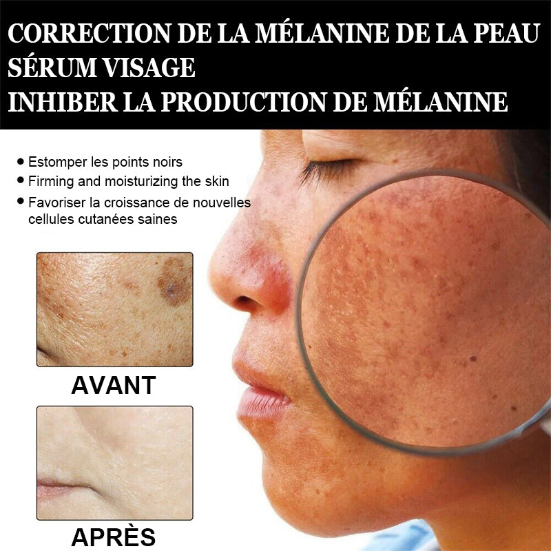 ✨Anti-taches rapide-Dobshow™ Melanin Correcting Facial Serum