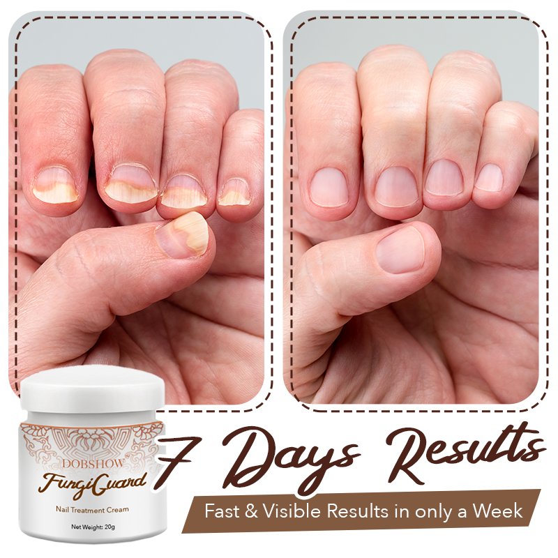 Dobshow™ FungiGuard Nail Treatment Cream