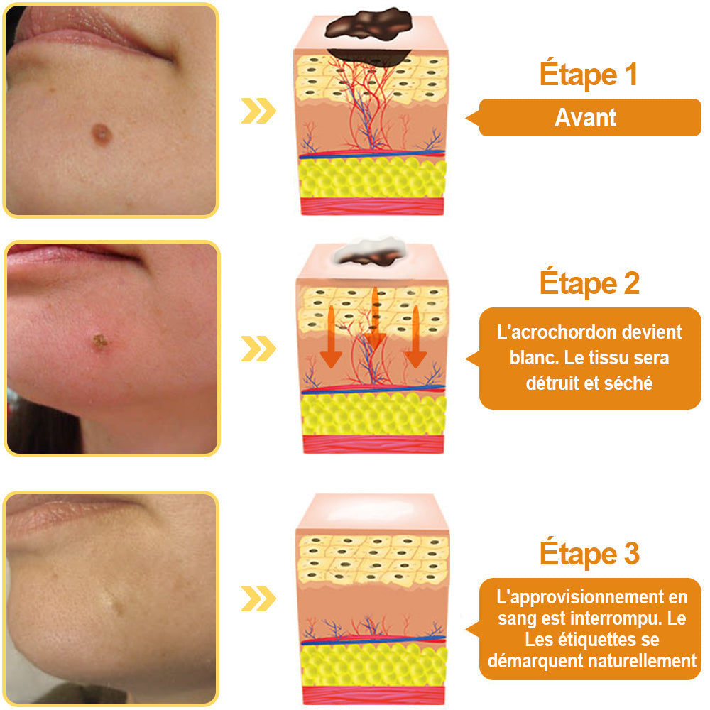 đDobshowâą Spray Perfection Peau au Venin d'Abeille : Ăliminez les Ătiquettes & Verrues Naturellement đâš