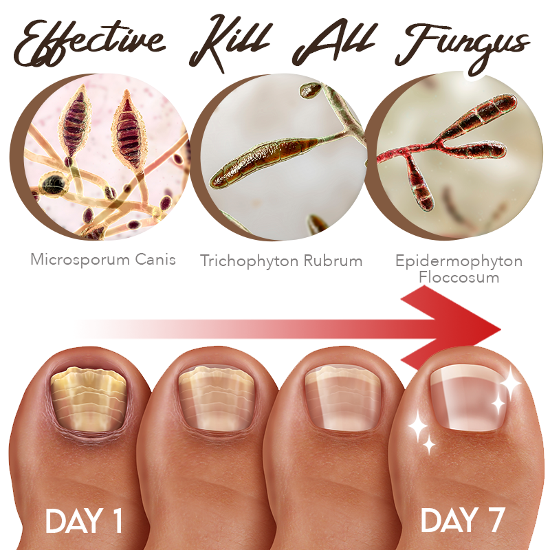 Dobshow™ FungiGuard Nail Treatment Cream