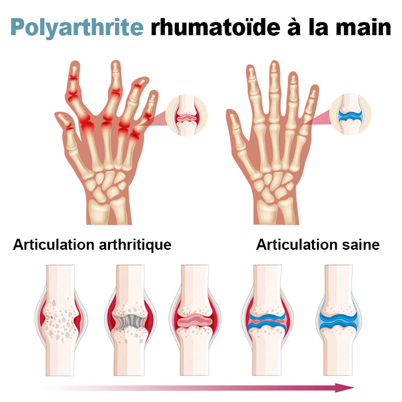 Dobshow™Crème hydratante avancée pour la réparation des articulations et des os🎉🐝