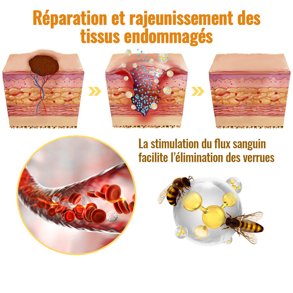 đDobshowâą Spray Perfection Peau au Venin d'Abeille : Ăliminez les Ătiquettes & Verrues Naturellement đâš