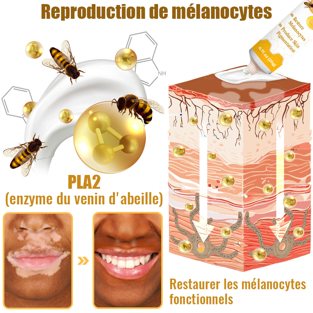 Dobshow™ BeeVenom Crème de traitement du vitiligo