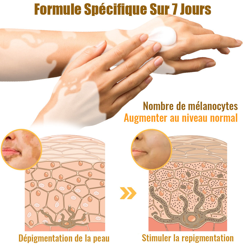 Dobshow™ BeeVenom Crème de traitement du vitiligo