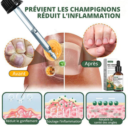 Cvreoz® Bee Venom Nail fungus care solution: Formule Naturelle pour les Ongles des Pieds et des Mains