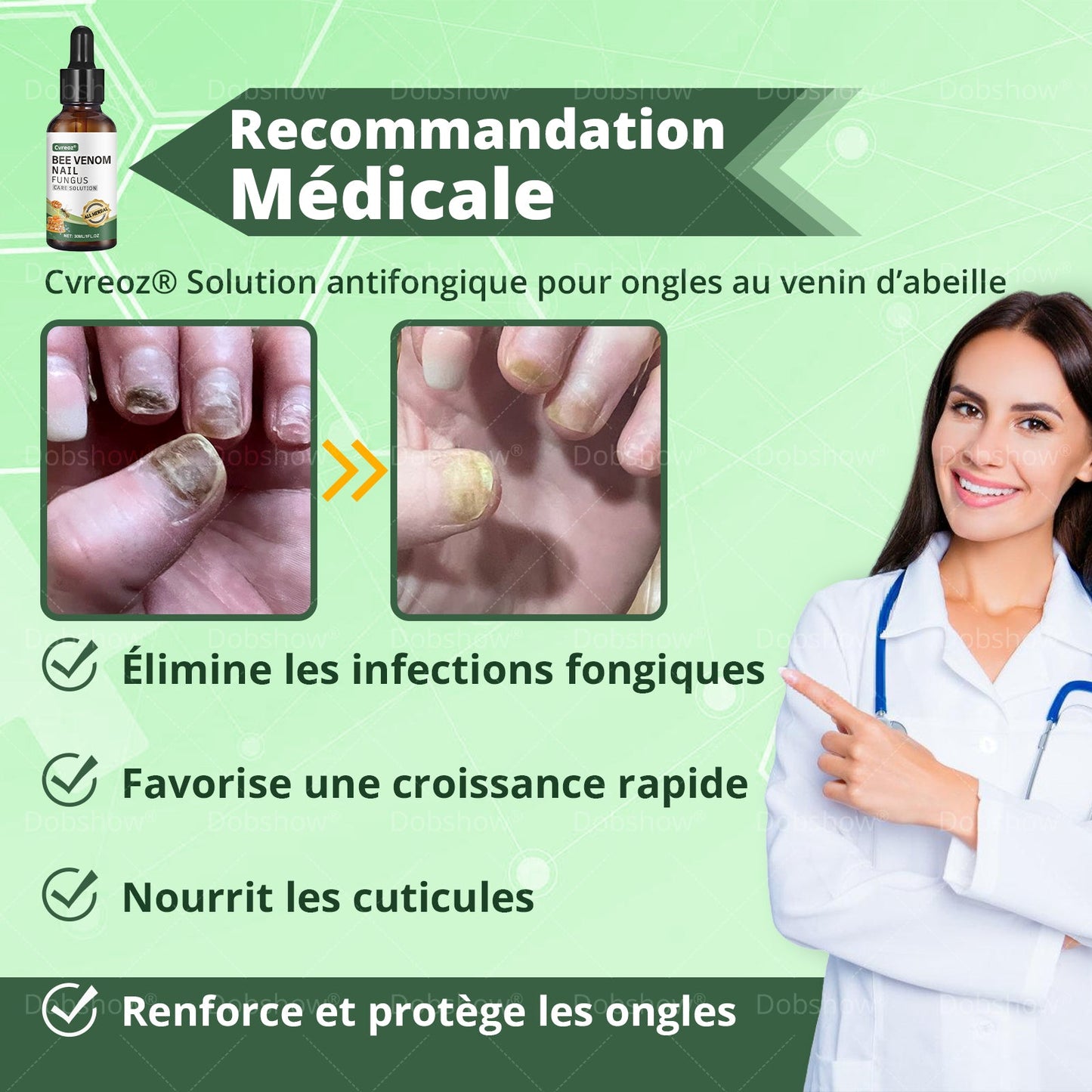 Cvreoz® Bee Venom Nail fungus care solution: Formule Naturelle pour les Ongles des Pieds et des Mains